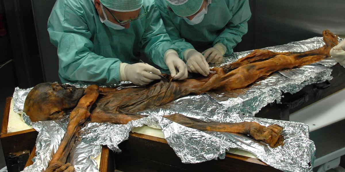 La mummia Ötzi al Museo Archeologico di Bolzano durante un'analisi nel 2010 (EPA/MUSEO ARCHEOLOGICO DI BOLZANO/EURAC/MARCO SAMADELLI, ANSA)