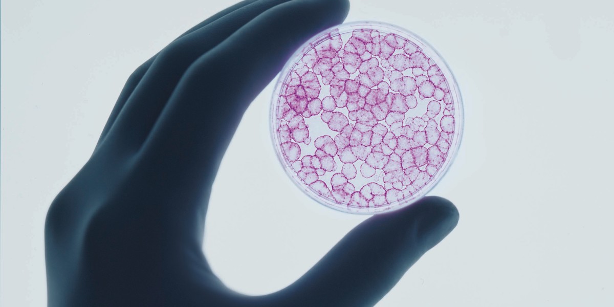 Il governo ha salvato dalla chiusura l’azienda che cura i “bambini farfalla”