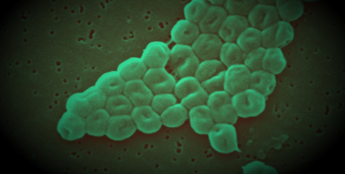 Acinetobacter baumannii (Wikimedia)
