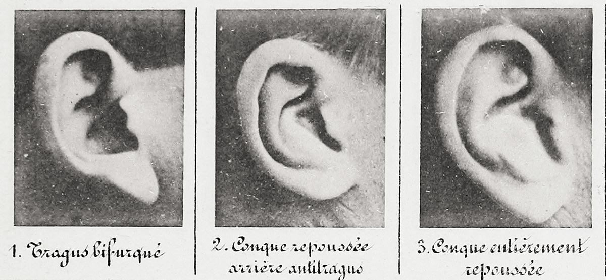 Particolare della classificazione degli orecchi in "Identification anthropométrique, instructions signalétiques d'Alphonse Bertillon", Parigi, 1893 (via Wikimedia)