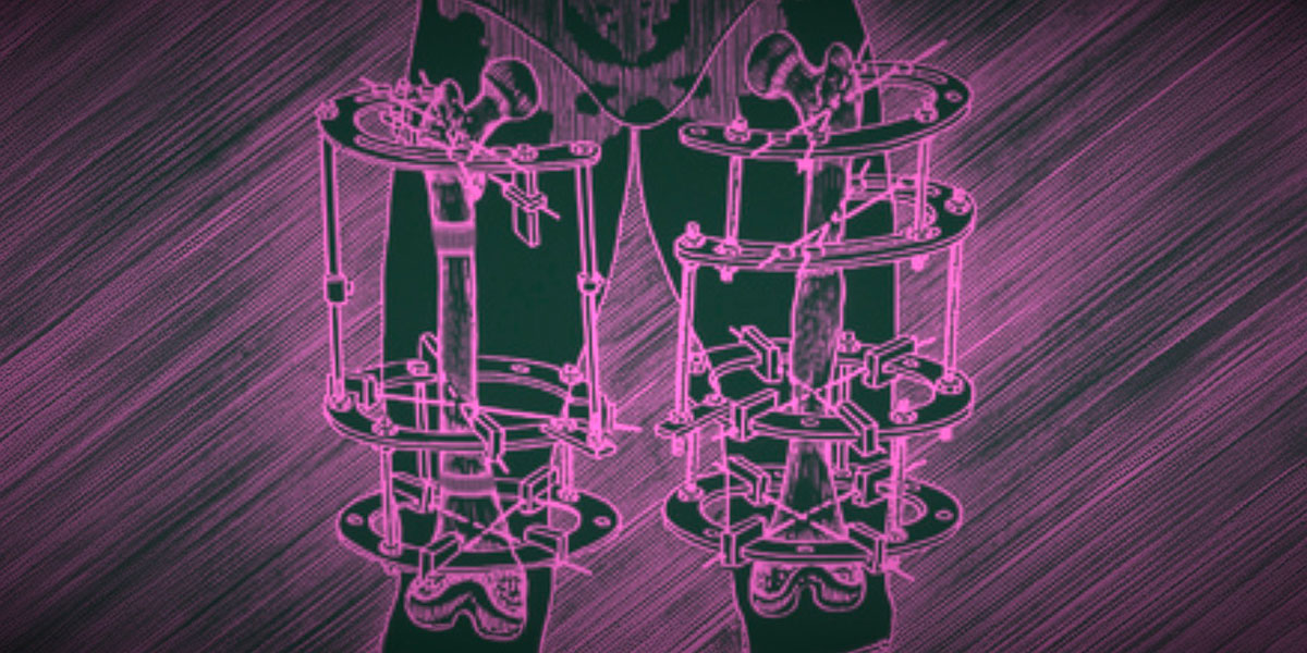 Gli interventi estetici per allungare le gambe