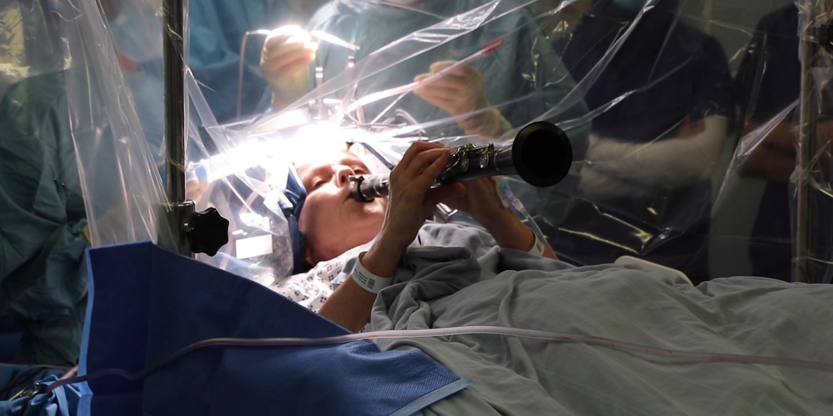 I pazienti che suonano durante le operazioni al cervello