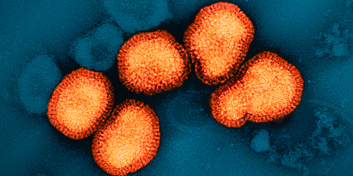 A(H3N2) al microscopio elettronico (Wikimedia)